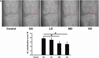 Protective Effect of SIRT1 Activator on the Knee With Osteoarthritis